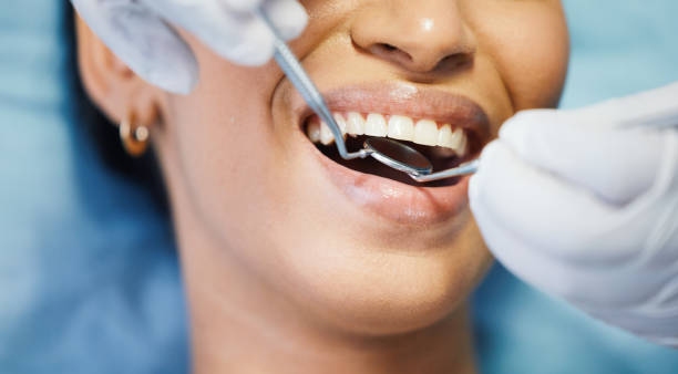 Best Emergency Root Canal Treatment in Ninnekah, OK