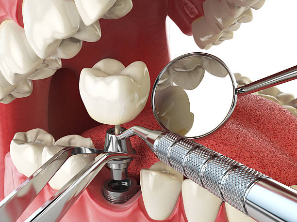 Best Emergency Orthodontic Repairs in Ninnekah, OK