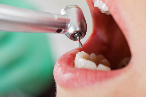Best Pediatric Emergency Dentist in Ninnekah, OK